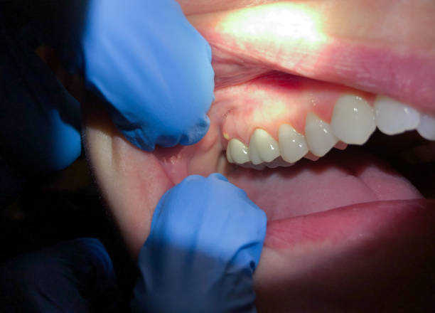 Best Emergency Dental Surgery in Salamanca, NY